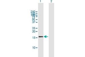 Image no. 1 for anti-TAF13 RNA Polymerase II, TATA Box Binding Protein (TBP)-Associated Factor, 18kDa (TAF13) (AA 1-124) antibody (ABIN948521)