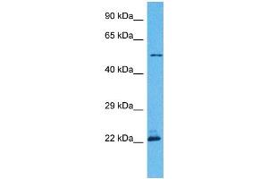 Image no. 5 for anti-Patatin-Like phospholipase Domain Containing 3 (PNPLA3) (C-Term) antibody (ABIN2783569)