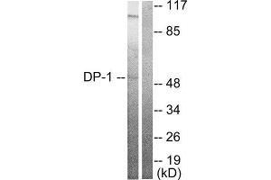 Image no. 2 for anti-Transglutaminase 4 (Prostate) (TGM4) (C-Term) antibody (ABIN1848512)