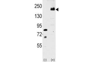 Image no. 3 for anti-Low Density Lipoprotein Receptor-Related Protein 6 (LRP6) (AA 1531-1560) antibody (ABIN3028807)