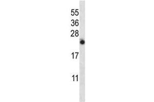 Image no. 4 for anti-Interleukin 13 (IL13) (AA 118-146) antibody (ABIN3031449)
