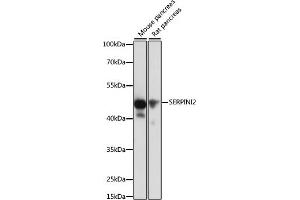 SERPINI2 抗体  (AA 56-405)