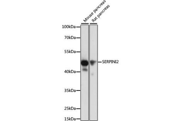 SERPINI2 Antikörper  (AA 56-405)