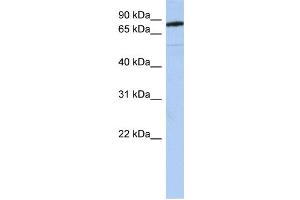 Image no. 1 for anti-Sema Domain, Immunoglobulin Domain (Ig), Transmembrane Domain (TM) and Short Cytoplasmic Domain, (Semaphorin) 4B (SEMA4B) (N-Term) antibody (ABIN2773943)