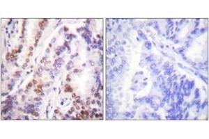 Image no. 2 for anti-Histone Deacetylase 9 (HDAC9) (AA 1017-1066) antibody (ABIN1533308)