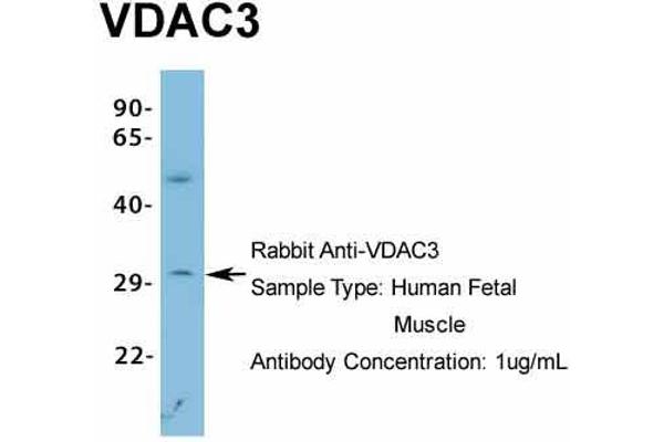 anti-Voltage-Dependent Anion Channel 3 (VDAC3) (N-Term) antibody