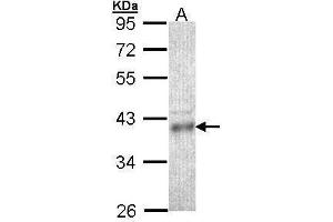 Image no. 1 for anti-Coproporphyrinogen Oxidase (CPOX) (Center) antibody (ABIN2854498)