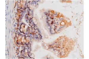 Image no. 10 for anti-Mast/stem Cell Growth Factor Receptor (KIT) (pTyr703) antibody (ABIN6255994)