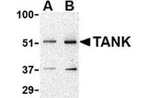 Image no. 2 for anti-TRAF Family Member-Associated NFKB Activator (TANK) (N-Term) antibody (ABIN500869)