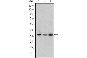 Image no. 1 for anti-LIM and Senescent Cell Antigen-Like Domains 1 (LIMS1) antibody (ABIN969354)