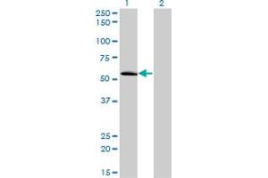 Western Blot analysis of ZNF622 expression in transfected 293T cell line by ZNF622 monoclonal antibody (M02), clone 3C5.