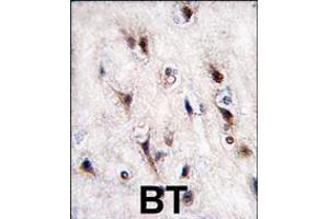 Image no. 2 for anti-Nuclear Receptor Subfamily 4, Group A, Member 2 (NR4A2) (AA 13-42), (N-Term) antibody (ABIN5537220)
