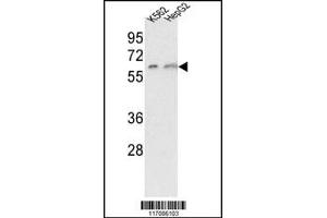 Western Blotting (WB) image for anti-Cytochrome P450, Family 7, Subfamily A, Polypeptide 1 (CYP7A1) antibody (ABIN2158470)