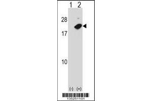 Image no. 1 for anti-Nudix (Nucleoside Diphosphate Linked Moiety X)-Type Motif 2 (NUDT2) (AA 62-90) antibody (ABIN5534203)