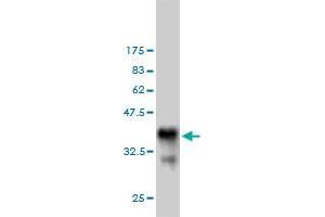Image no. 4 for anti-Bifunctional Apoptosis Regulator (BFAR) (AA 101-200) antibody (ABIN565579)