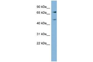 Image no. 2 for anti-Glutamine-Fructose-6-Phosphate Transaminase 2 (GFPT2) (Middle Region) antibody (ABIN2775298)