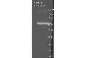 Image no. 2 for anti-serpin Peptidase Inhibitor, Clade A (Alpha-1 Antiproteinase, Antitrypsin), Member 1 (SERPINA1) antibody (ABIN107860)