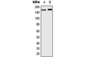 Image no. 3 for anti-AT Rich Interactive Domain 1B (SWI1-Like) (ARID1B) (Center) antibody (ABIN2705563)