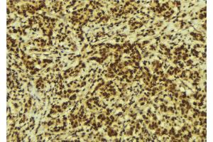 Image no. 4 for anti-Cysteine and Glycine-Rich Protein 1 (CSRP1) antibody (ABIN6258036)