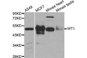 Image no. 2 for anti-Wilms Tumor 1 (WT1) antibody (ABIN3021698)