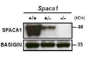 anti-Sperm Acrosome Associated 1 (SPACA1) (C-Term) antibody
