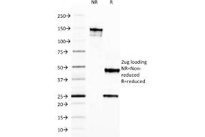 Image no. 5 for anti-Ferritin, Light Polypeptide (FTL) (AA 38-165) antibody (ABIN6939459)