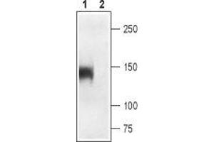 anti-Calcium Channel, Voltage-Dependent, L Type, alpha 1S Subunit (CACNA1S) (2nd Extracellular Loop), (AA 506-518), (Domain 4) antibody