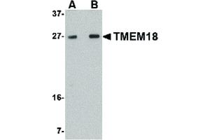 Image no. 1 for anti-Transmembrane Protein 18 (TMM18) (C-Term) antibody (ABIN6657331)