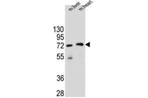 Image no. 2 for anti-Potassium Channel Tetramerisation Domain Containing 8 (KCTD8) (AA 441-470), (C-Term) antibody (ABIN953023)