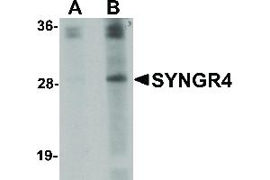 Image no. 1 for anti-Synaptogyrin 4 (SYNGR4) (N-Term) antibody (ABIN6656391)