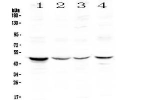 Image no. 1 for anti-Caspase 4, Apoptosis-Related Cysteine Peptidase (CASP4) (AA 111-194) antibody (ABIN5693193)