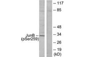 Image no. 1 for anti-Jun B Proto-Oncogene (JUNB) (AA 226-275), (pSer259) antibody (ABIN1531891)