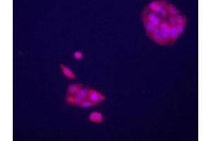Immunofluorecence staining of GPC3 antibody on HepG2 cells.