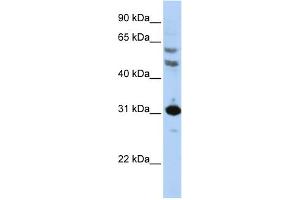 Image no. 1 for anti-Homeobox B5 (HOXB5) (N-Term) antibody (ABIN2787516)