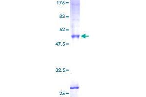 Image no. 1 for Phosphatidic Acid Phosphatase Type 2C (PPAP2C) (AA 1-288) protein (GST tag) (ABIN1315824)