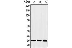 Western blot analysis of HOXA11/D11 expression in HEK293T (A), HeLa (B), K562 (C) whole cell lysates.