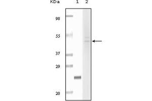 Image no. 2 for anti-Fibulin 5 (FBLN5) antibody (ABIN1107239)