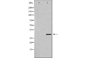 Image no. 1 for anti-Homeobox A9 (HOXA9) (Internal Region) antibody (ABIN6262341)