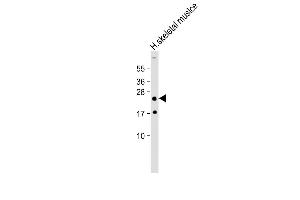 Anti-HOXA7 Antibody (Center) at 1:2000 dilution + Human skeletal muslce lysate Lysates/proteins at 20 μg per lane.