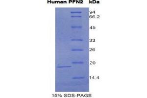 Image no. 1 for Profilin 2 (PFN2) (AA 5-140) protein (His tag) (ABIN1981176)