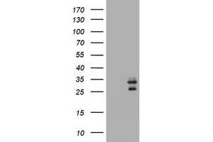 Image no. 4 for anti-CD99 (CD99) antibody (ABIN1497382)
