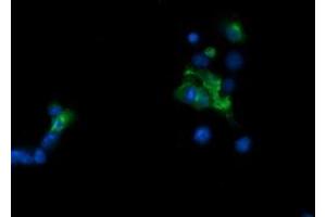 Image no. 4 for anti-TAP Binding Protein-Like (TAPBPL) antibody (ABIN1501300)