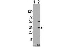 Image no. 1 for anti-Signal Sequence Receptor, alpha (SSR1) (N-Term) antibody (ABIN356936)