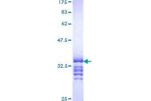 Image no. 1 for Pre-B-Cell Leukemia Homeobox 4 (PBX4) (AA 319-374) protein (GST tag) (ABIN1314116)