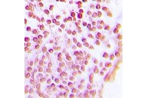 Image no. 2 for anti-Sirtuin 1 (SIRT1) antibody (ABIN3198318)