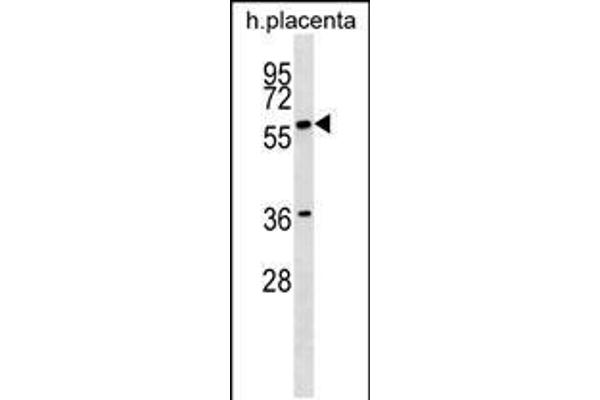 GAB3 antibody  (N-Term)