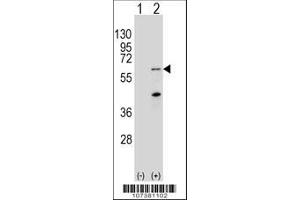 Image no. 2 for anti-PTEN Induced Putative Kinase 1 (PINK1) (AA 118-147), (N-Term) antibody (ABIN390369)