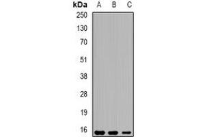 Image no. 2 for anti-Eppin (SPINLW1) antibody (ABIN2966607)