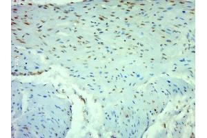 NF-kB p65 antibody  (AA 51-100)