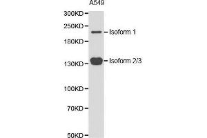 Western blot analysis of extracts of A549 cell line, using TET2 antibody.